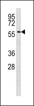 CCDC155 Antibody (Center)