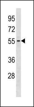 GTDC1 Antibody (Center)