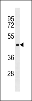 CWC27 Antibody (C-term)