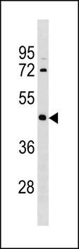IRX1 Antibody (N-term)