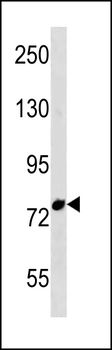 FBXO43 Antibody (C-term)