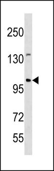 ESCO1 Antibody (C-term)