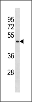 BCL6B Antibody (Center)
