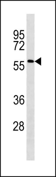 ACSF2 Antibody (C-term)