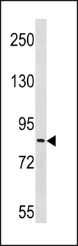 ZC3H11A Antibody (N-term)