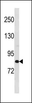 ZC3H11A Antibody (N-term)