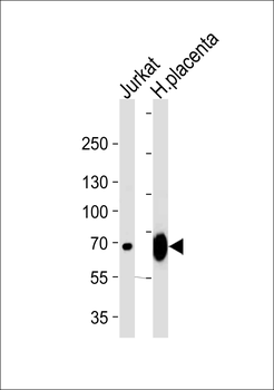 LIMK2 Antibody (C-term)