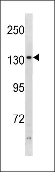 PHKA2 Antibody (N-term)
