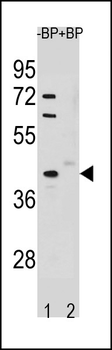 STK25 Antibody (C-term)