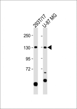 SGSM1 Antibody (Center)