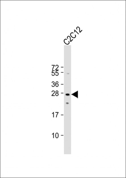 Mouse p27Kip1 Antibody (C-term T197)