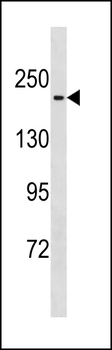 Mouse Mast1 Antibody (C-term)