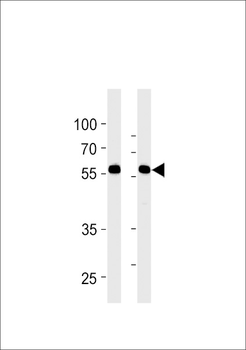 RFTN1 Antibody (Center)