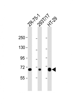 SLC28A1 Antibody (Center)