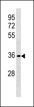 RFPL3 Antibody (N-term)