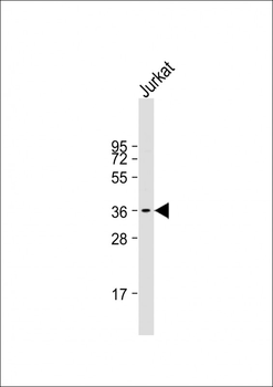 RFPL3 Antibody (N-term)