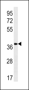 OXGR1 Antibody (C-term)