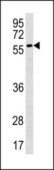 PLXDC2 Antibody (N-term)