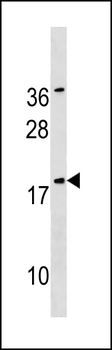 SNX12 Antibody (Center)
