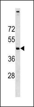 C11orf24 Antibody (N-term)