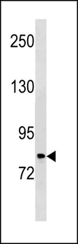 PLOD2 Antibody (C-term)