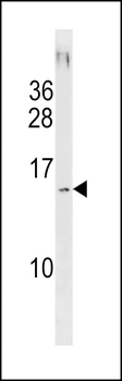 SAMD13 Antibody (C-term)