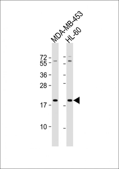 ZNF740 Antibody (N-term)