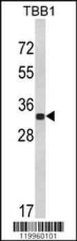 His Tag Antibody