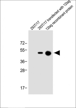 His Tag Antibody
