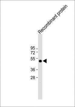 His Tag Antibody