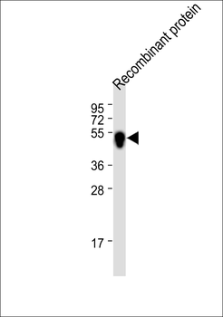 His Tag Antibody