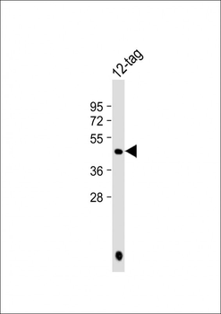 HIS Tag Antibody