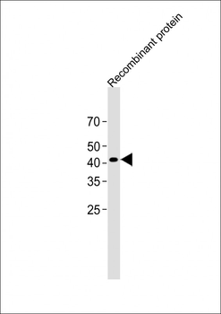 HIS Tag Antibody