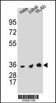 TYSY Antibody(C-term)
