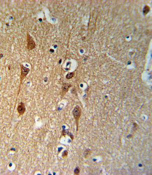 SMAD3-S208 Antibody