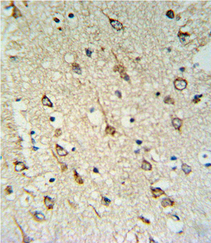 DNAJC6 Antibody (Center)
