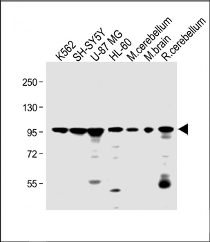 DNAJC6 Antibody (Center)