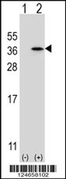 SPDYA Antibody (Center)