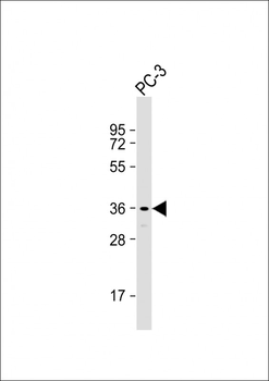 SPDYA Antibody (Center)