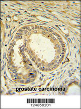 SPDYA Antibody (Center)
