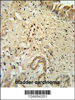 ID4 Antibody (N-term)