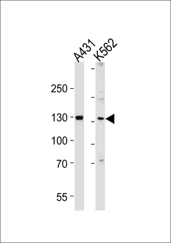 GALNT5 Antibody (N-term)