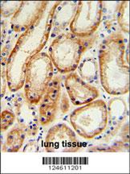 GALNT5 Antibody (N-term)
