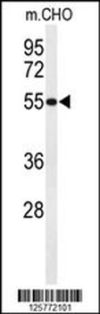 HIAT1 Antibody (C-term)