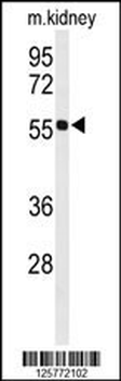 HIAT1 Antibody (C-term)
