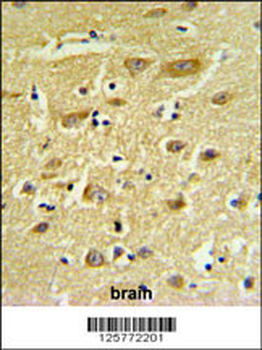 HIAT1 Antibody (C-term)