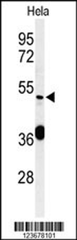 DDX49 Antibody (C-term)