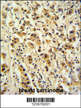 DDX49 Antibody (C-term)
