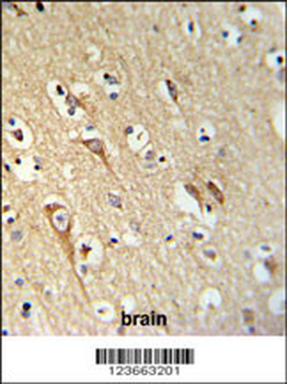 ALG10 Antibody (N-term)