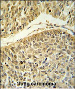 RERE Antibody (N-term)